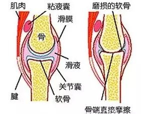 一個很神的外用偏方！專治“膝蓋滑膜炎” - 養(yǎng)生堂 - 養(yǎng)生堂
