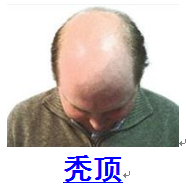 健康百科 - 財富玫瑰 - 財富玫瑰（陽光月月）