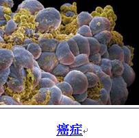 健康百科 - 財富玫瑰 - 財富玫瑰