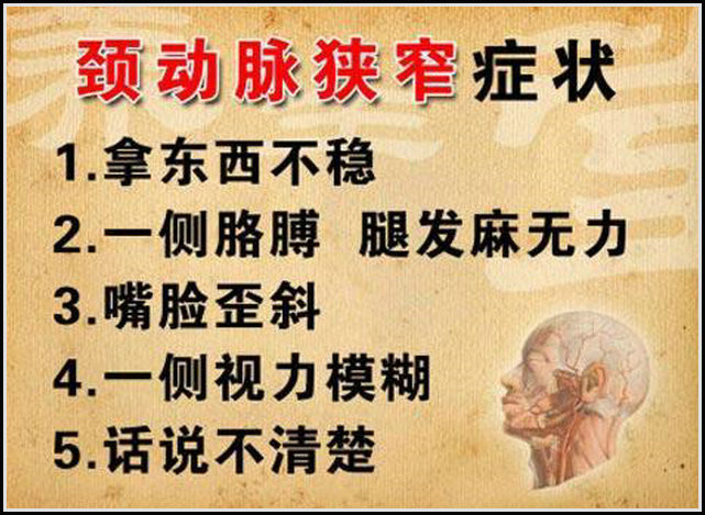 預(yù)防和治療心腦血管病 - 山野村夫 - 自由人.山野村夫 專家:血管老化和去除動(dòng)脈粥樣硬化斑塊的方法 - 逍遙客 - 逍遙客