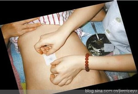 2.60元的藥外敷神闕，治好了女兒的鼻炎 - 瀛子 - 瀛の小箋