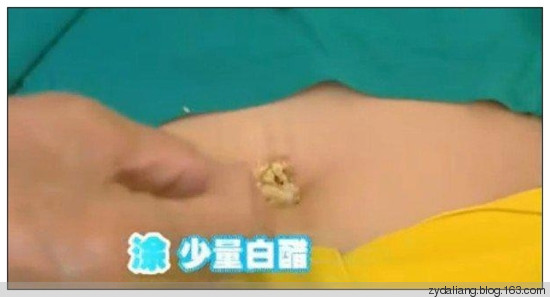 三天見效！一毛錢成本的治便秘妙方 - 瀛子 - 瀛の小箋