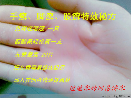 手癬腳癬秘方 - 逍遙客 - 逍遙客