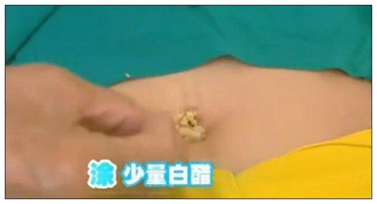 便秘妙方 - 艾古 - 逆向思維博客 艾古